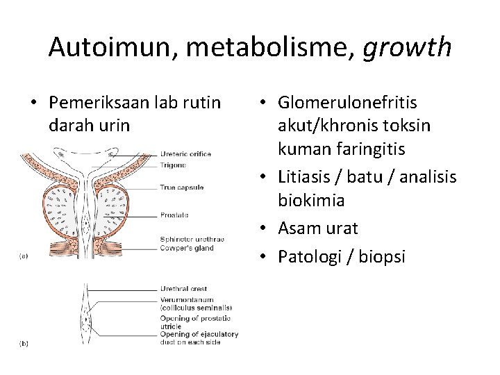 Autoimun, metabolisme, growth • Pemeriksaan lab rutin darah urin • Glomerulonefritis akut/khronis toksin kuman