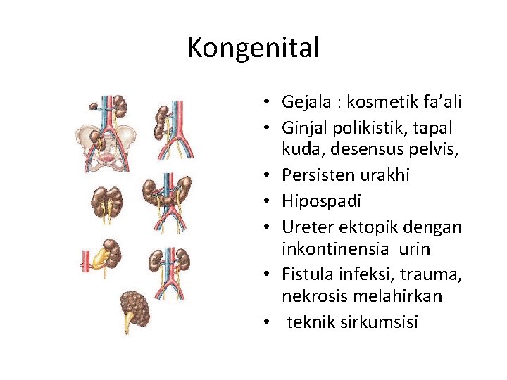 Kongenital • Gejala : kosmetik fa’ali • Ginjal polikistik, tapal kuda, desensus pelvis, • Kongenital • Gejala : kosmetik fa’ali • Ginjal polikistik, tapal kuda, desensus pelvis, •