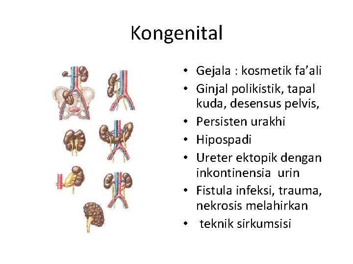 Kongenital • Gejala : kosmetik fa’ali • Ginjal polikistik, tapal kuda, desensus pelvis, •