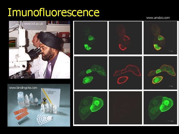 Imunofluorescence www. kcl. ac. uk www. bindingsite. com www. amsbio. com 