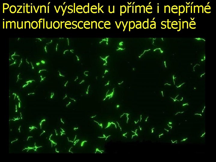 Pozitivní výsledek u přímé i nepřímé imunofluorescence vypadá stejně 