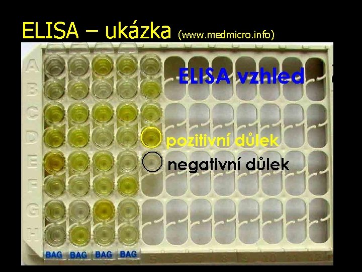 ELISA – ukázka (www. medmicro. info) 