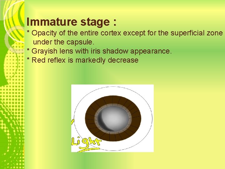 Immature stage : * Opacity of the entire cortex except for the superficial zone