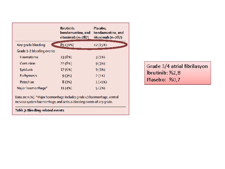 Grade 3/4 atrial fibrilasyon İbrutinib: %2, 8 Plasebo: %0, 7 