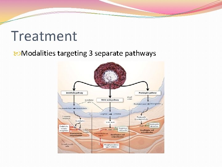 Treatment Modalities targeting 3 separate pathways 