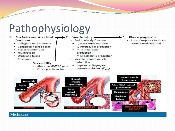 Pathophysiology 