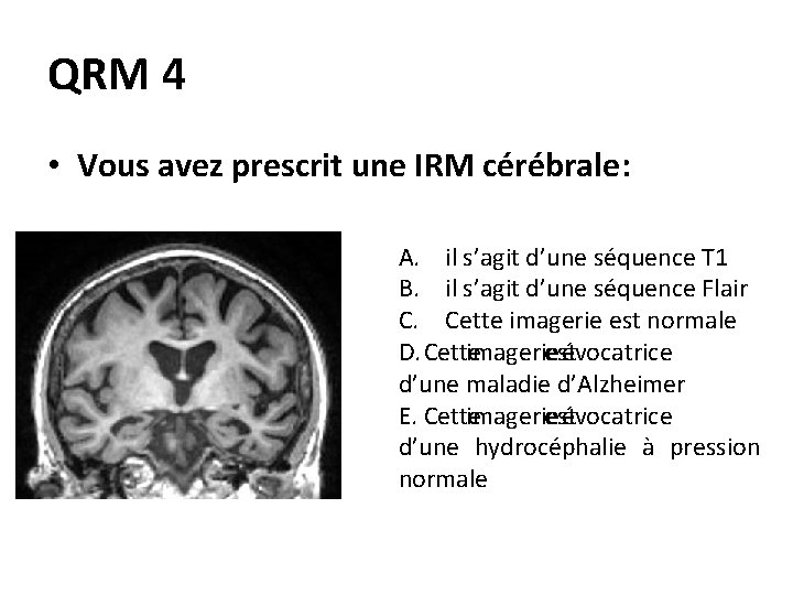 QRM 4 • Vous avez prescrit une IRM cérébrale: A. il s’agit d’une séquence