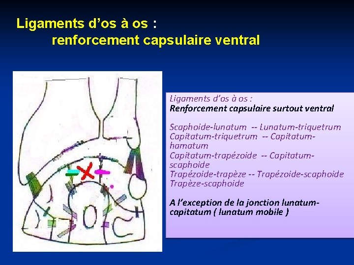 Ligaments d’os à os : renforcement capsulaire ventral Ligaments d’os à os : Renforcement