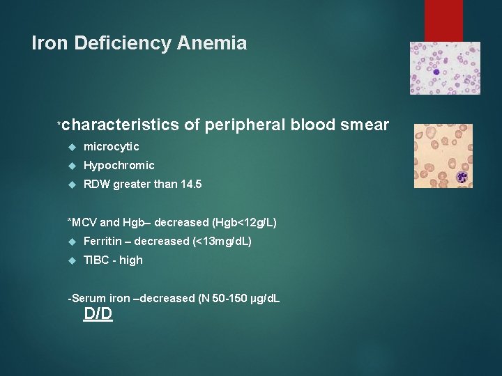 Iron Deficiency Anemia *characteristics of peripheral blood smear microcytic Hypochromic RDW greater than 14.