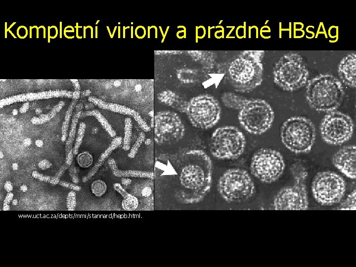 Kompletní viriony a prázdné HBs. Ag www. uct. ac. za/depts/mmi/stannard/hepb. html. 