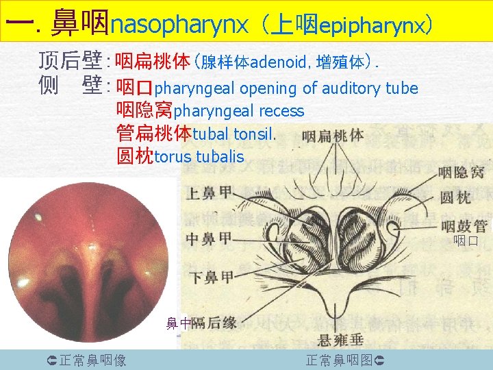 一. 鼻咽nasopharynx (上咽epipharynx) 顶后壁: 咽扁桃体(腺样体adenoid, 增殖体). 侧 壁: 咽口pharyngeal opening of auditory tube 咽隐窝pharyngeal