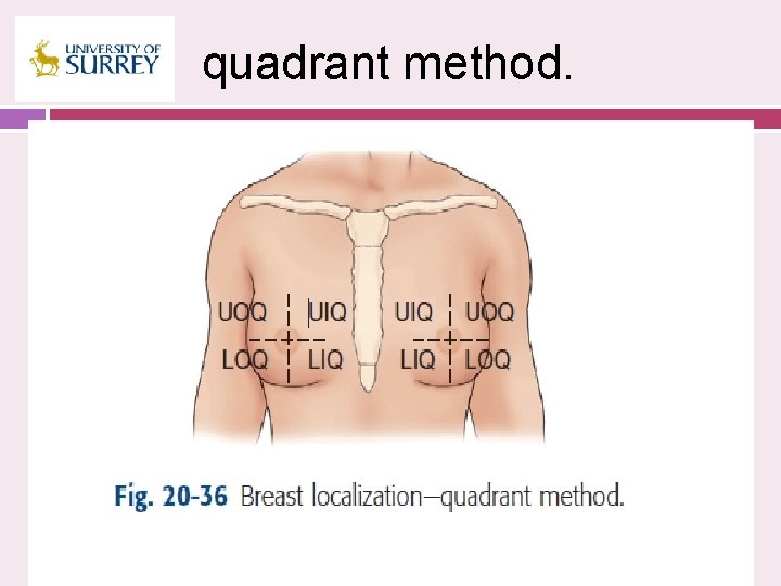 quadrant method. 