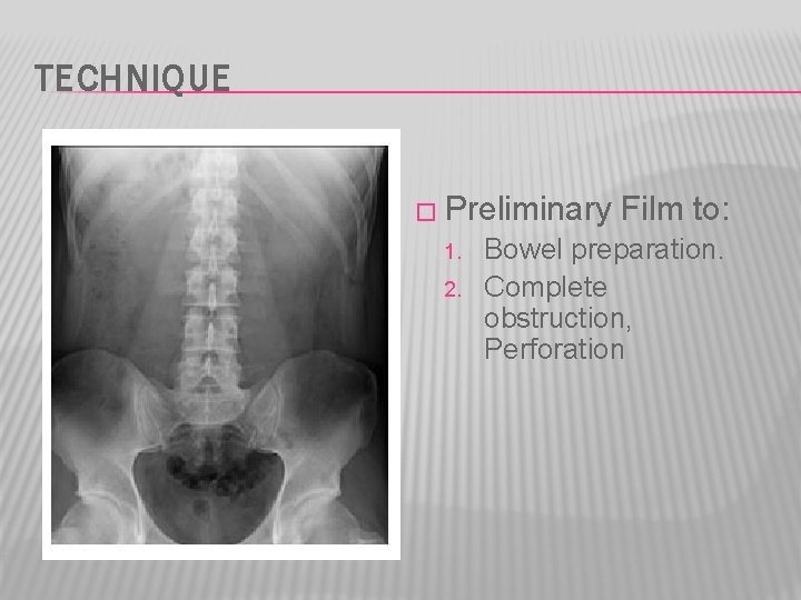 TECHNIQUE � Preliminary 1. 2. Film to: Bowel preparation. Complete obstruction, Perforation 