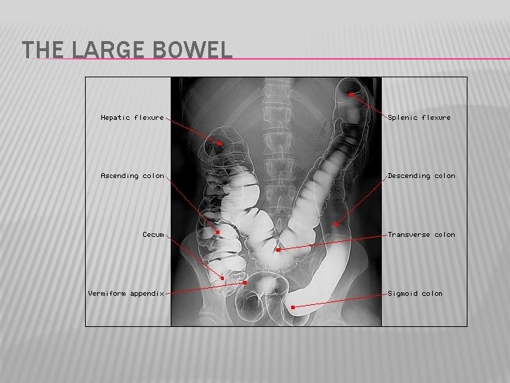 THE LARGE BOWEL 