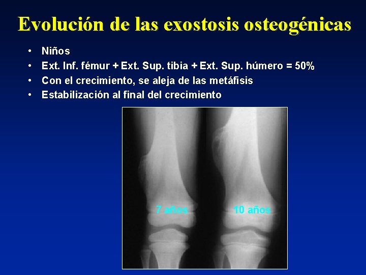 Evolución de las exostosis osteogénicas • • Niños Ext. Inf. fémur + Ext. Sup.