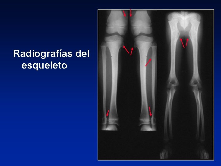 Radiografías del esqueleto 