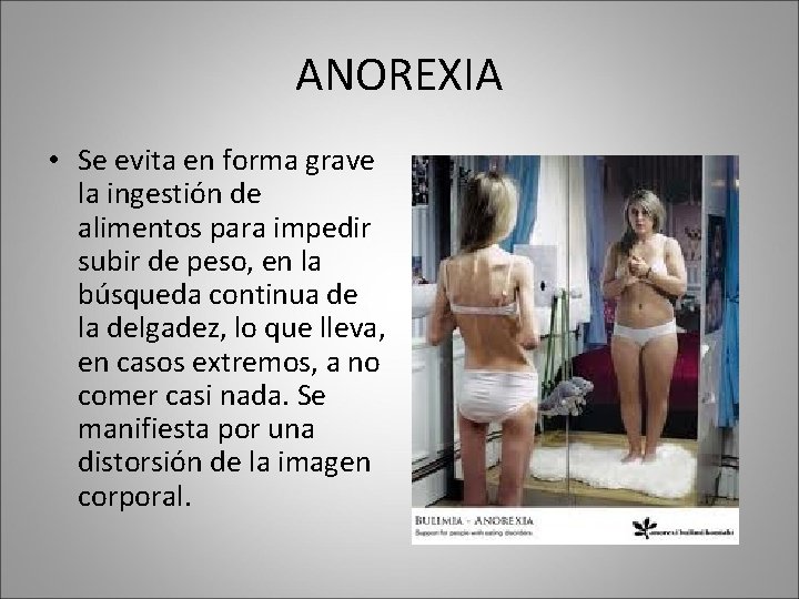 ANOREXIA • Se evita en forma grave la ingestión de alimentos para impedir subir