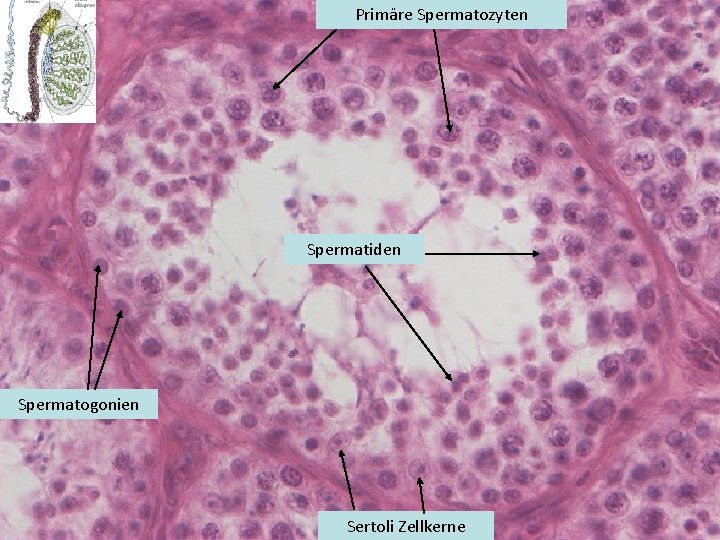 Primäre Spermatozyten Spermatiden Spermatogonien Sertoli Zellkerne 