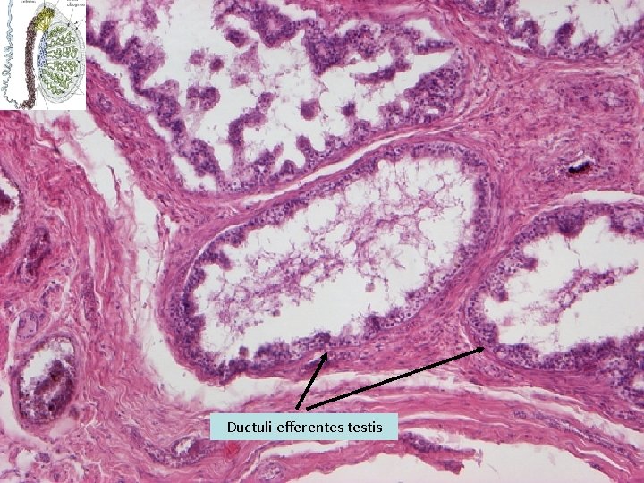 Ductuli efferentes testis 