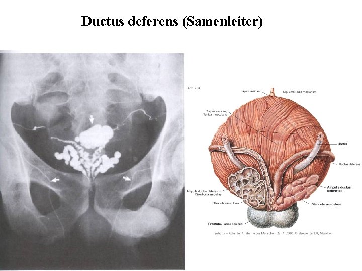 Ductus deferens (Samenleiter) 