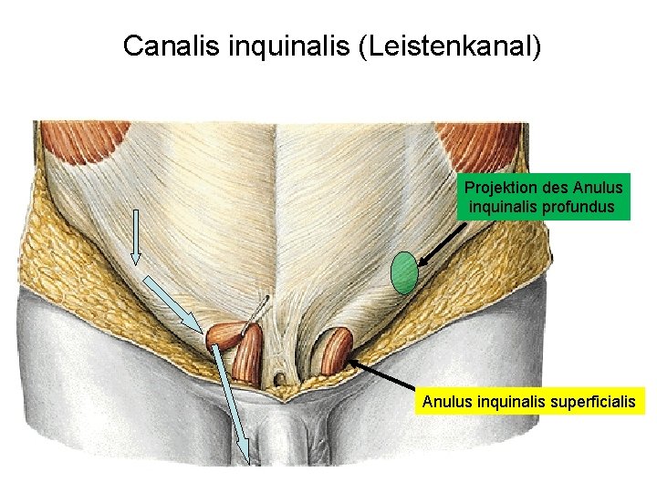 Canalis inquinalis (Leistenkanal) Projektion des Anulus inquinalis profundus Anulus inquinalis superficialis 
