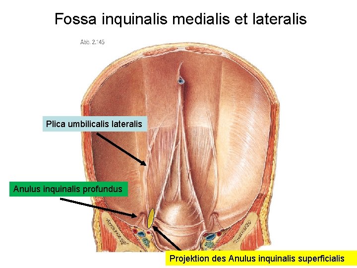 Fossa inquinalis medialis et lateralis Plica umbilicalis lateralis Anulus inquinalis profundus Projektion des Anulus