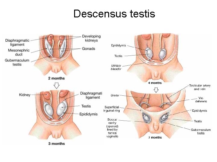 Descensus testis 