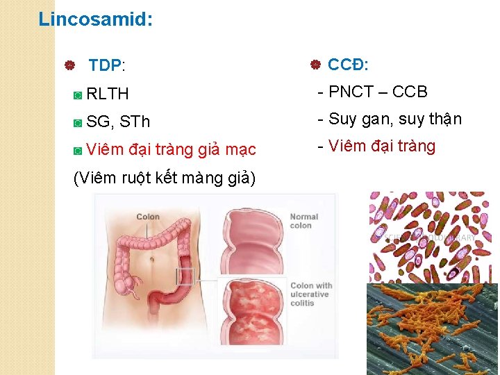 Lincosamid: | TDP: | CCĐ: ◙ RLTH - PNCT – CCB ◙ SG, STh