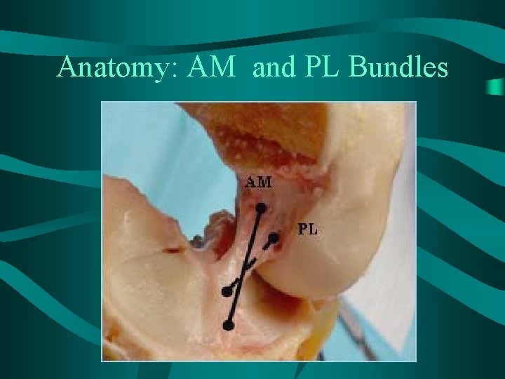 Anatomy: AM and PL Bundles 