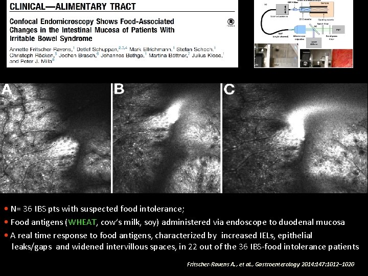  • N= 36 IBS pts with suspected food intolerance; • Food antigens (WHEAT,