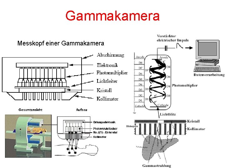 Gammakamera Messkopf einer Gammakamera 