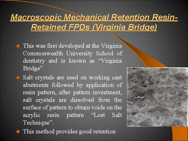 Macroscopic Mechanical Retention Resin. Retained FPDs (Virginia Bridge) This was first developed at the
