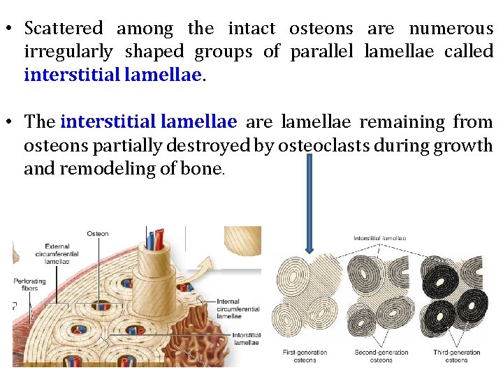  • Scattered among the intact osteons are numerous irregularly shaped groups of parallel