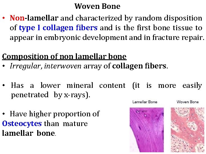 Woven Bone • Non-lamellar and characterized by random disposition of type I collagen fibers