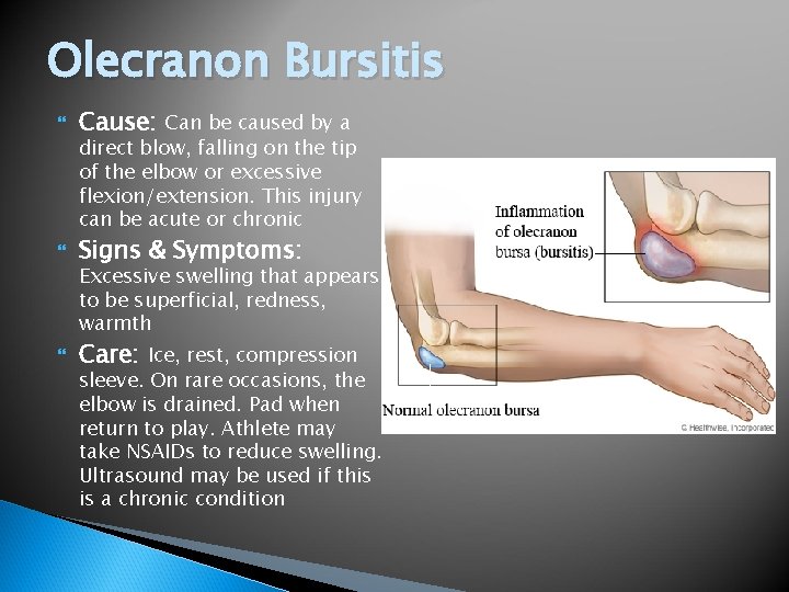 Olecranon Bursitis Cause: Can be caused by a Signs & Symptoms: Care: Ice, rest,