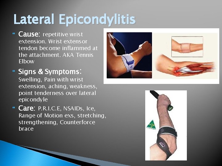 Lateral Epicondylitis Cause: repetitive wrist Signs & Symptoms: extension. Wrist extensor tendon become inflammed