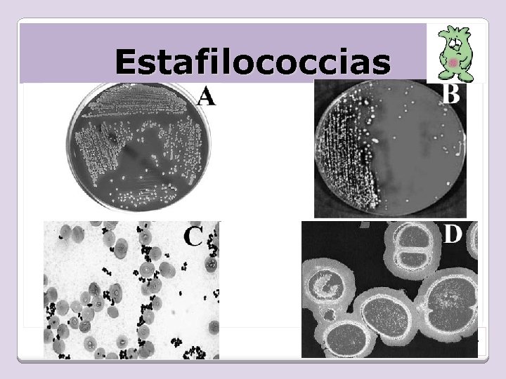 Estafilococcias Farhat K. C et al, 2008. 