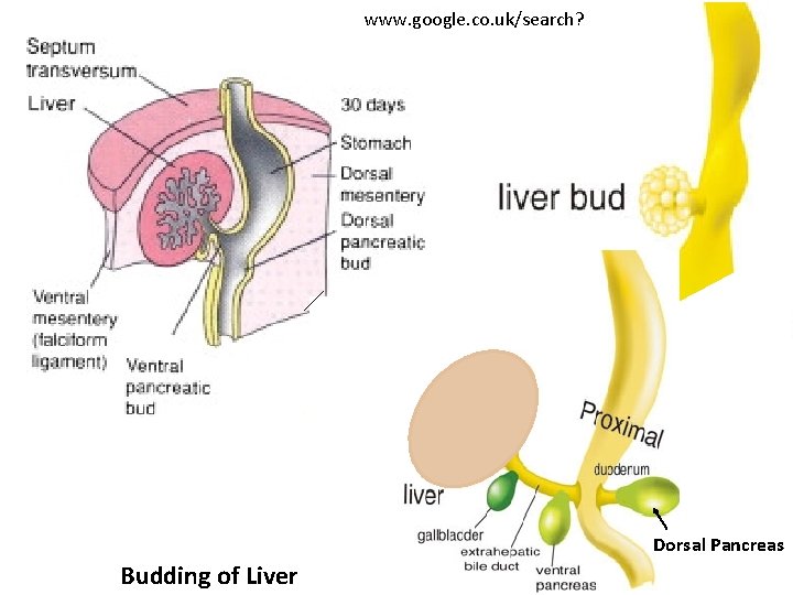 www. google. co. uk/search? Dorsal Pancreas Budding of Liver 