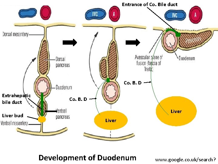 Entrance of Co. Bile duct Co. B. D Extrahepatic bile duct Liver bud Co.