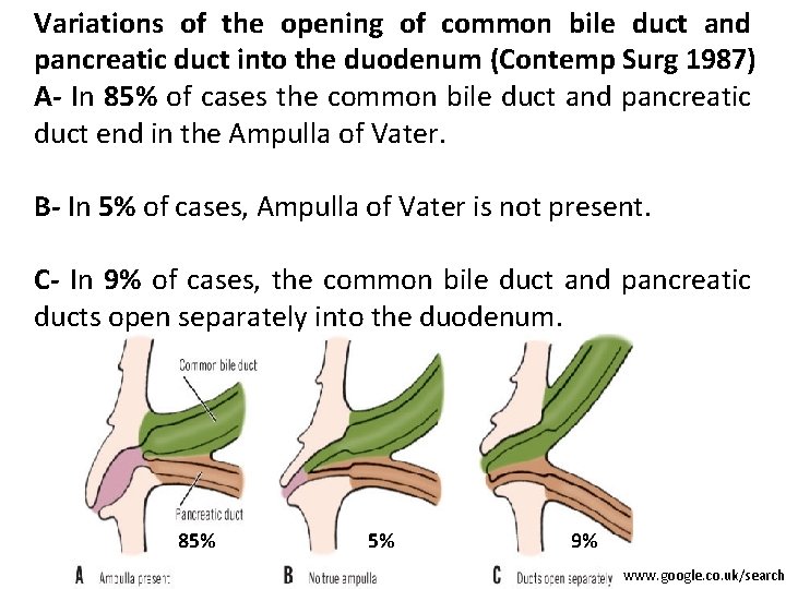 Variations of the opening of common bile duct and pancreatic duct into the duodenum