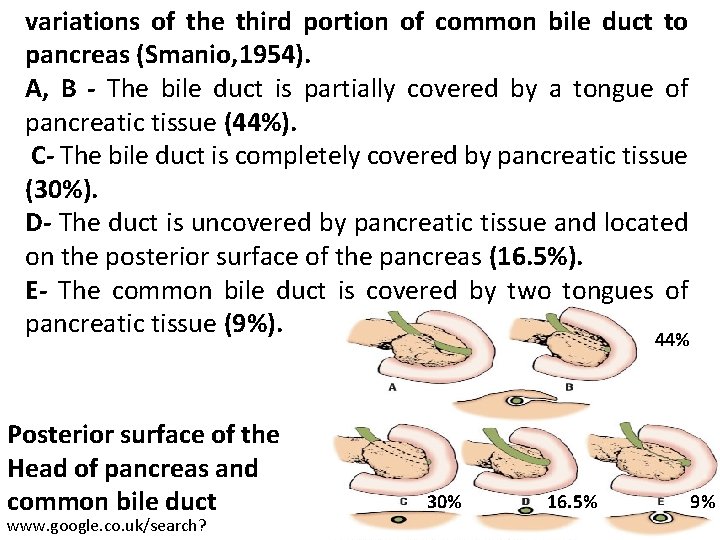 variations of the third portion of common bile duct to pancreas (Smanio, 1954). A,