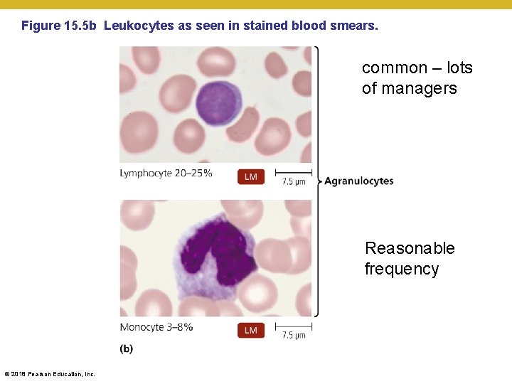 Figure 15. 5 b Leukocytes as seen in stained blood smears. common – lots