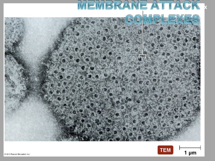 MEMBRANE ATTACK Membrane attack complex COMPLEXES 