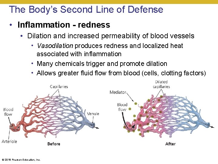 The Body’s Second Line of Defense • Inflammation - redness • Dilation and increased