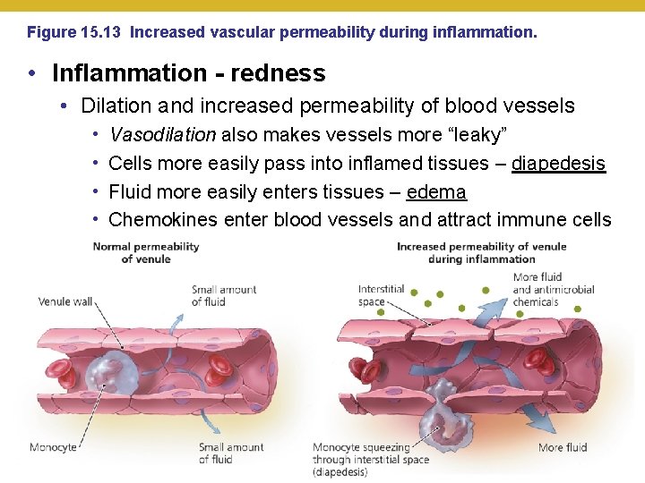 Figure 15. 13 Increased vascular permeability during inflammation. • Inflammation - redness • Dilation