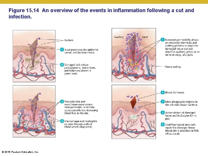Figure 15. 14 An overview of the events in inflammation following a cut and