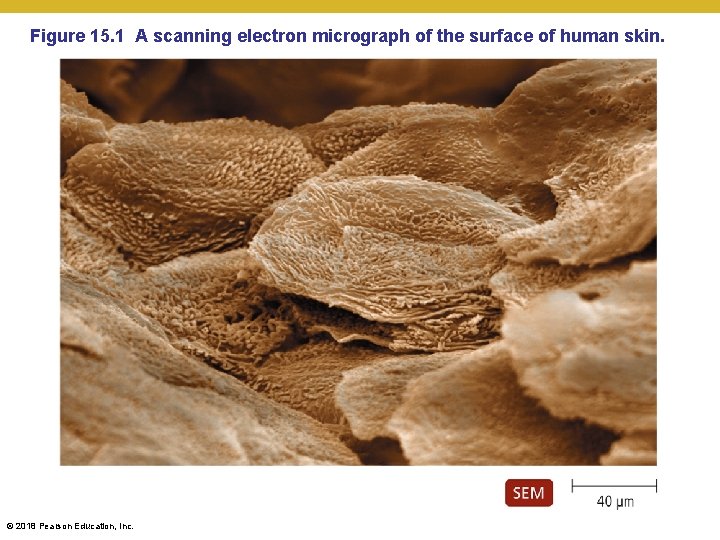 Figure 15. 1 A scanning electron micrograph of the surface of human skin. ©