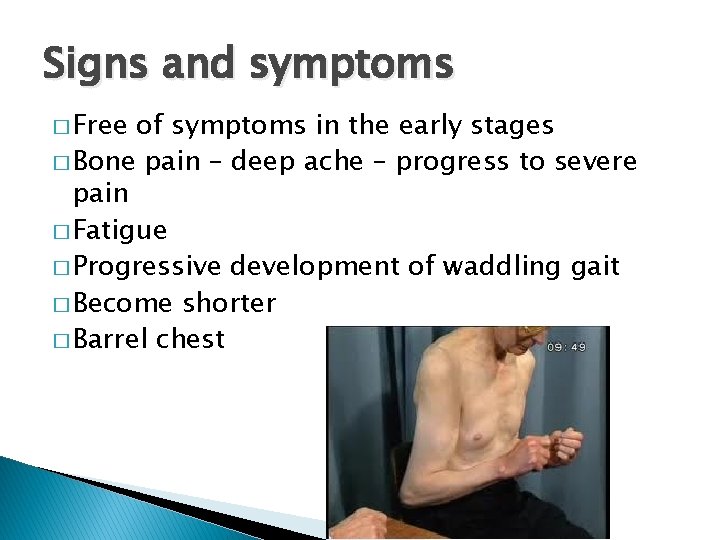Signs and symptoms � Free of symptoms in the early stages � Bone pain