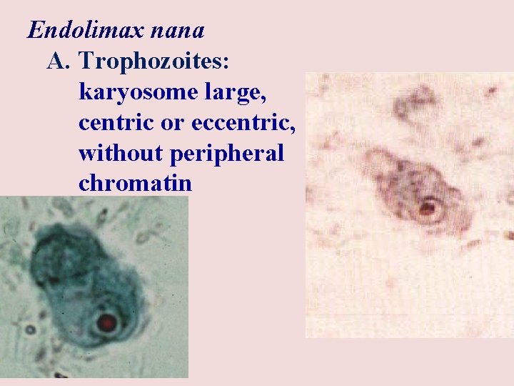 Endolimax nana A. Trophozoites: karyosome large, centric or eccentric, without peripheral chromatin 