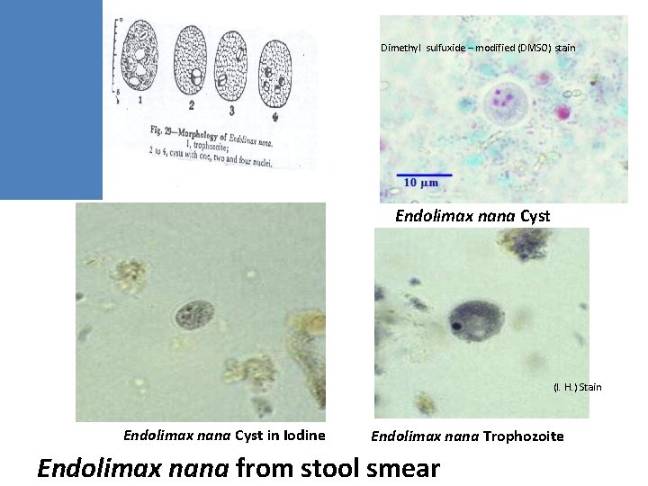 Dimethyl sulfuxide – modified (DMSO) stain Endolimax nana Cyst (I. H. ) Stain Endolimax